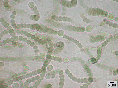 Nostoc (cyanobacteria) species - Microscopic view